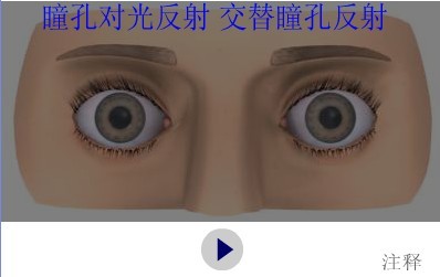 瞳孔对光反射 交替瞳孔反射