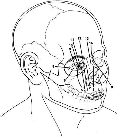 Tessier Cleft Classification