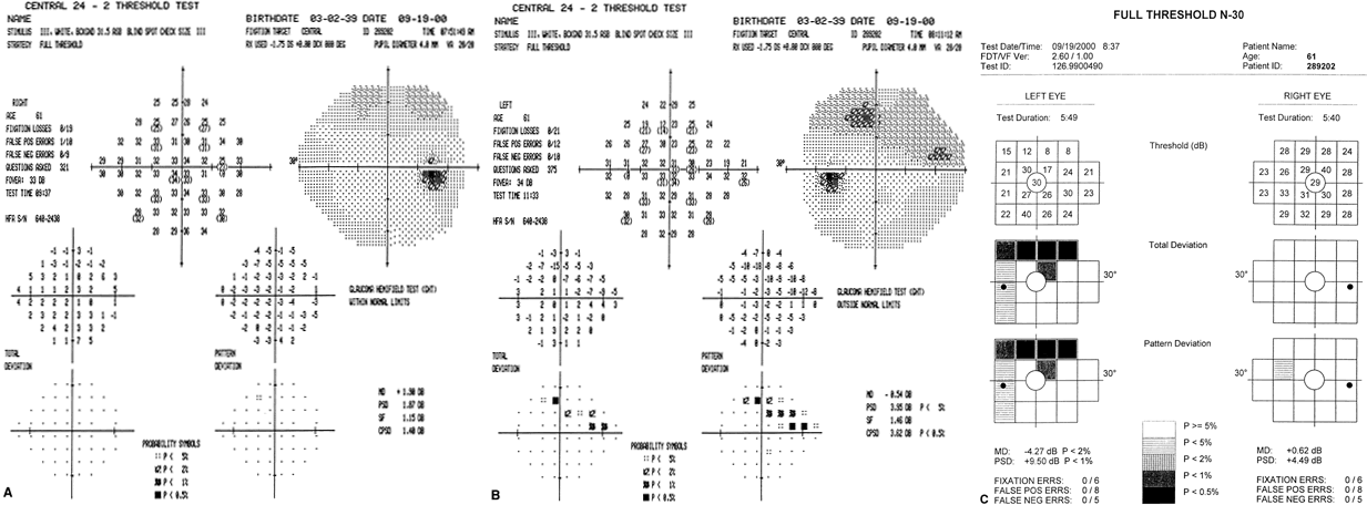 nasal visual field