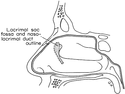 fossa of rosenmuller. the lacrimal sac fossa and