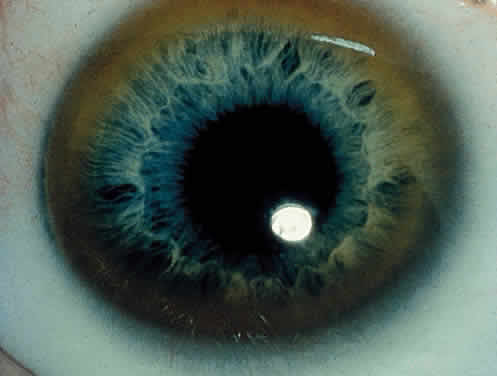 Cornea Farinata