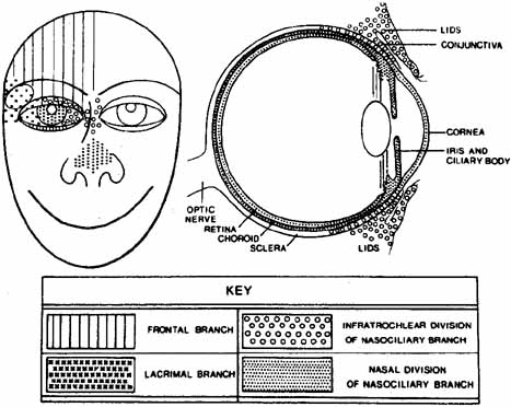 herpes zoster eye. D Herpes Zoster