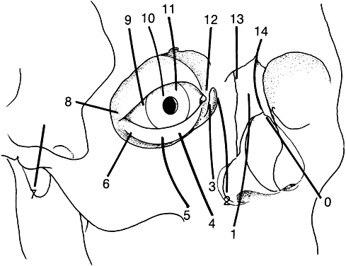 Tessier Cleft Classification