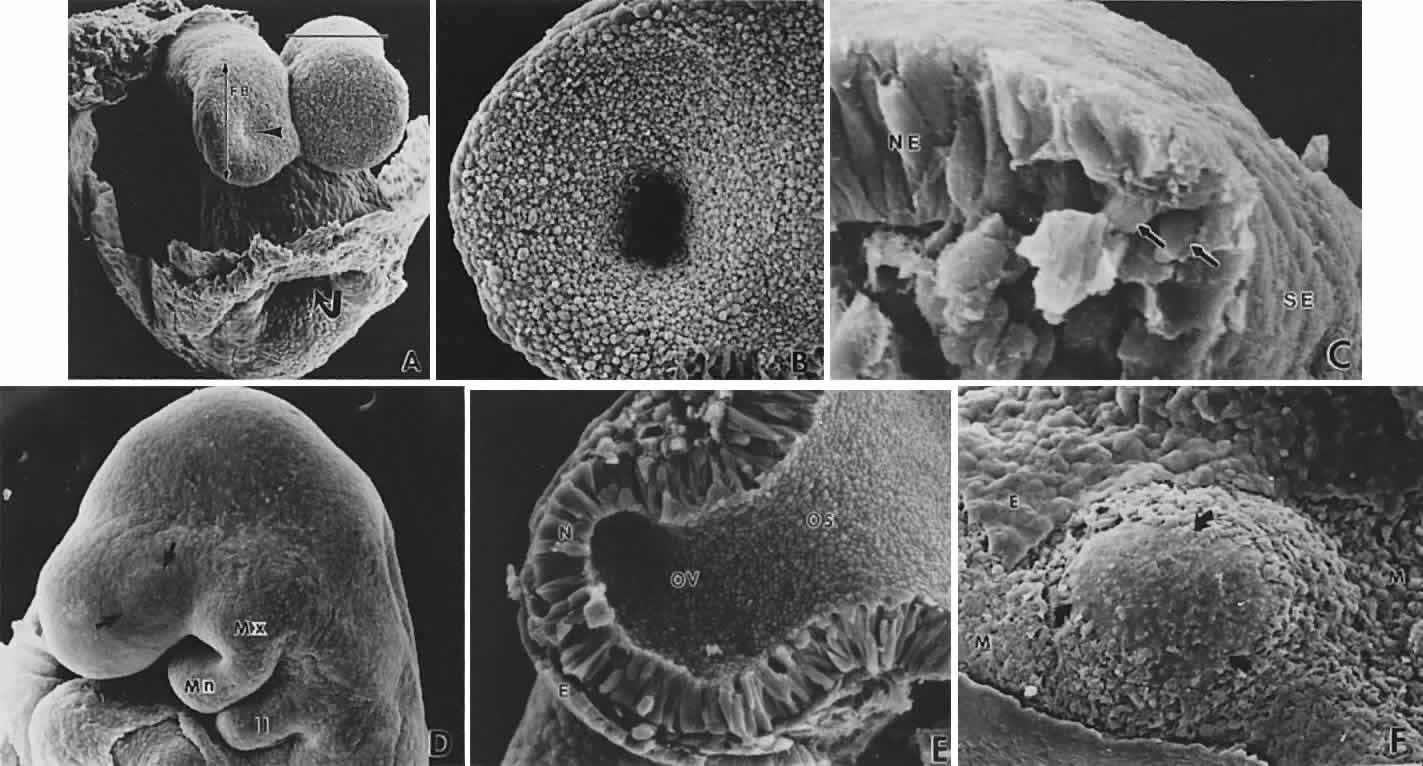 day 4 embryo