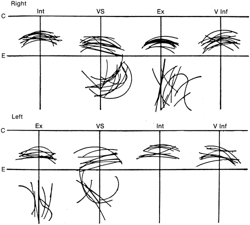 c  corneal limbus  e  equator  int  medial rectus  vs  superior rectus  ex
