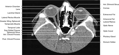 Foundation Volume 1, Chapter 35. Advanced Neuroimaging Techniques for