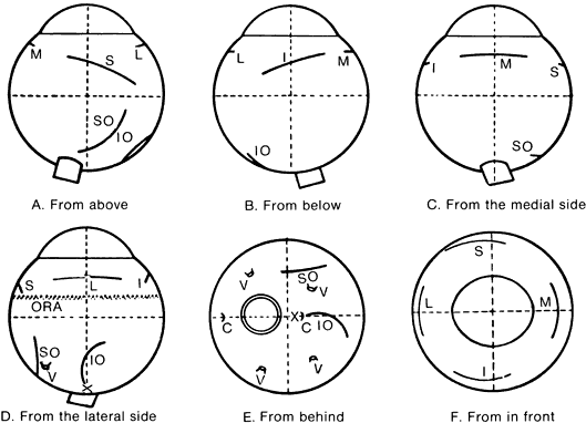 inferior oblique  io   medial rectus  m   lateral rectus  l