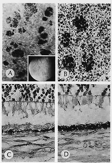 What are pigment granules?