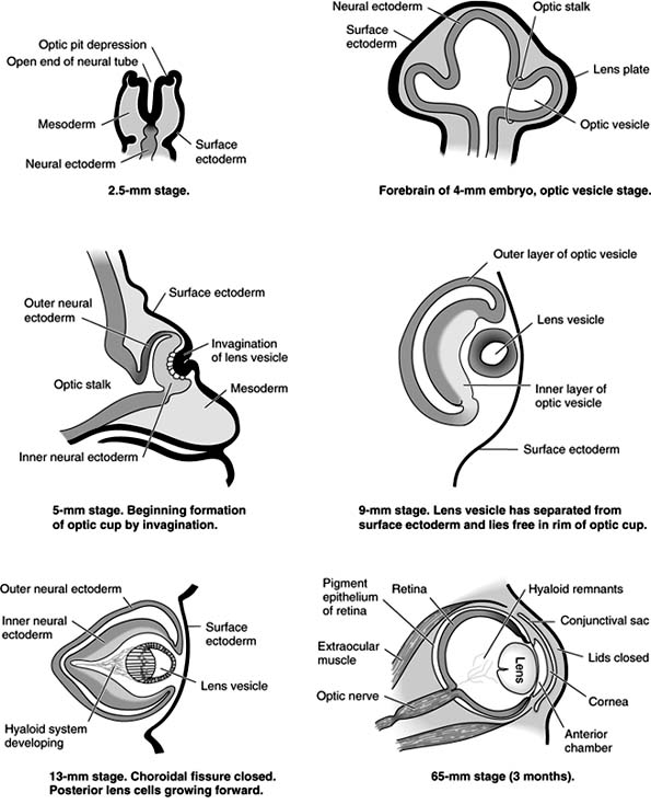 Figure 1-28