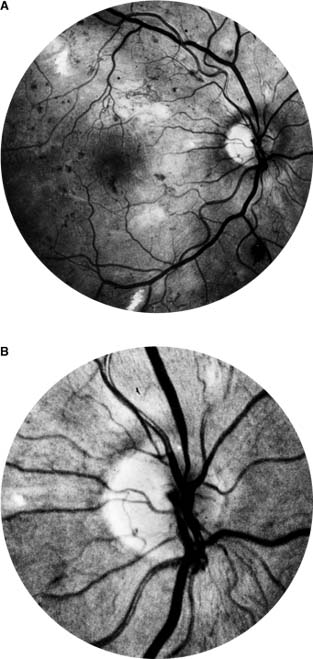 Figure 2-17