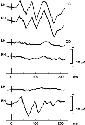 Figure 2-30