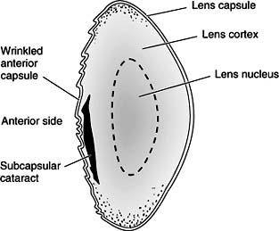 Figure 8-7