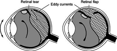 Figure 9-15