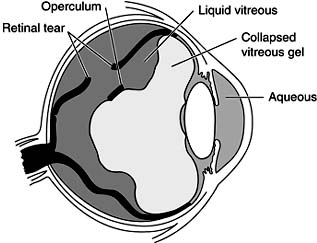 Figure 9-6