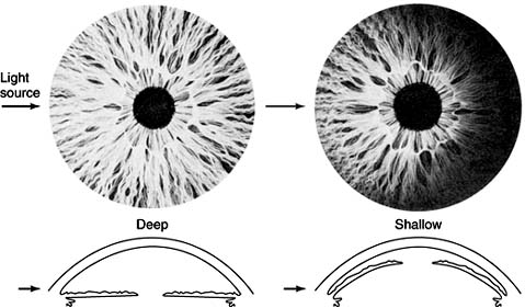 Figure 11-4