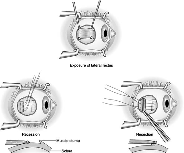 Figure 12-6