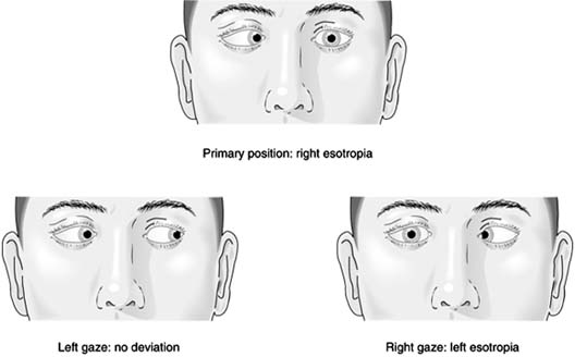 Figure 12-9