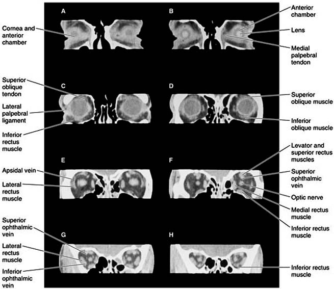 Figure 13-2