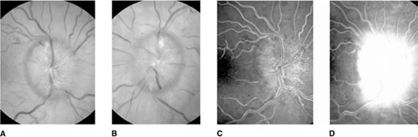 Figure 14-15