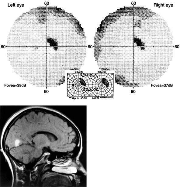 Figure 14-4