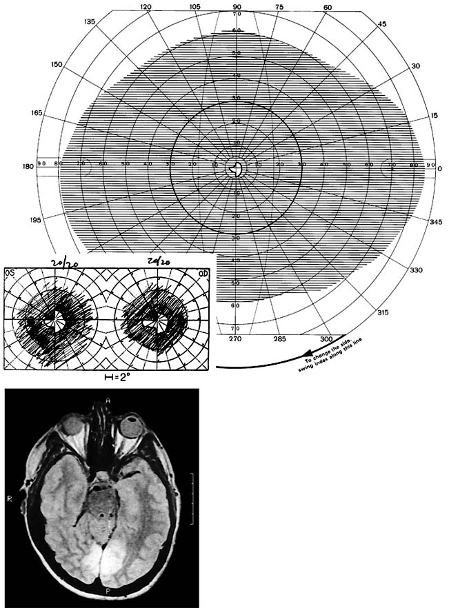 Figure 14-5