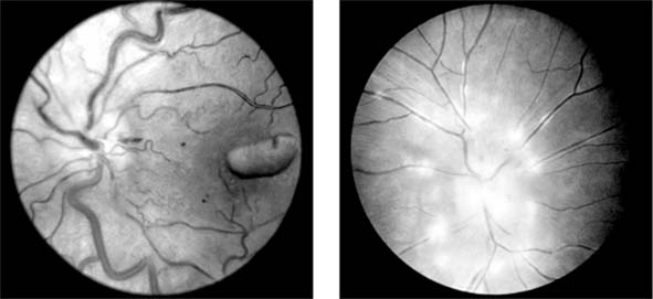 Figure 15-14