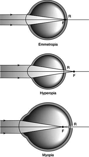 Figure 20-21