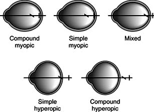 Figure 20-22