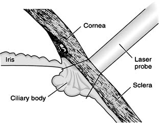 Figure 24-4